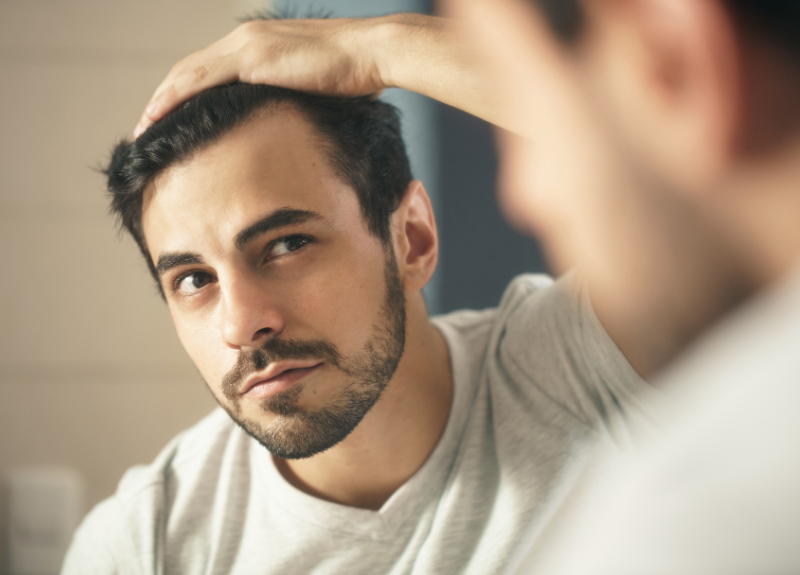 Bye-Bye Rambut Rontok! Coba Perawatan Alami Sesuai Sunnah Deh